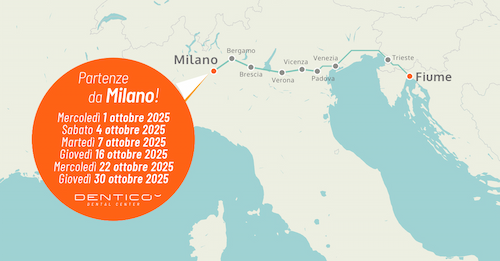 Trasporto organizzato