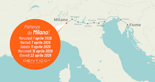 Trasporto organizzato
